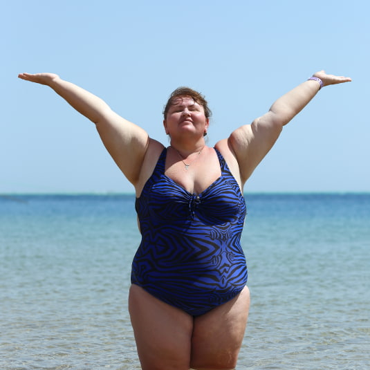 fat-woman-in-the-beach-before